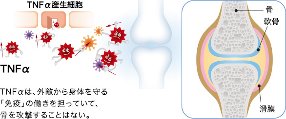 TNFαは、外敵から身体を守る「免疫」の働きを担っていて、骨を攻撃することはない。