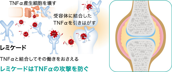 TNFαと結合してその働きをおさえる。レミケードはTNFαの攻撃を防ぐ